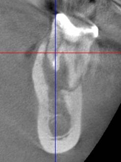 口を開けているウサギ
中程度の精度で自動的に生成された説明