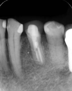 白黒の写真
低い精度で自動的に生成された説明