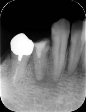 白黒の写真
低い精度で自動的に生成された説明
