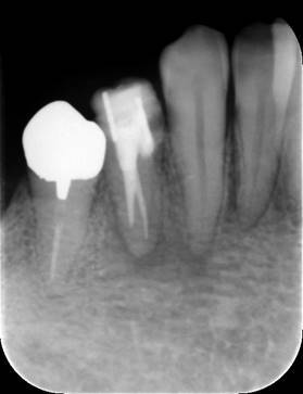 白黒の写真
低い精度で自動的に生成された説明