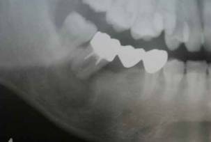 ����: ����: ����: ����: ����: ����: ����: ����: ����: ����: ����: ����: ����: ����: ����: ����: ����: ����: ����: ����: ����: ����: ����: ����: ����: ����: ����: ����: ����: ����: ����: ����: ����: ����: ����: ����: ����: ����: ����: ����: ����: ����: ����: ����: ����: ����: ����: ����: ����: ����: ����: image001