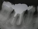 http://aoki-dentaloffice-kochi.com/endodontics.files/image149.jpg