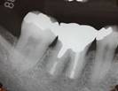 http://aoki-dentaloffice-kochi.com/endodontics.files/image153.jpg