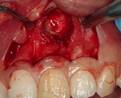 http://aoki-dentaloffice-kochi.com/endodontics.files/image143.jpg