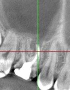 http://aoki-dentaloffice-kochi.com/endodontics.files/image232.jpg