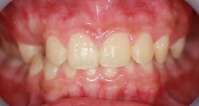 屋内, 食品, 皿, フルーツ が含まれている画像
AI 生成コンテンツは誤りを含む可能性があります。