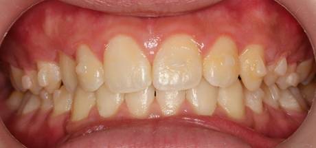 食品, ボウル, 座る, 皿 が含まれている画像
AI 生成コンテンツは誤りを含む可能性があります。