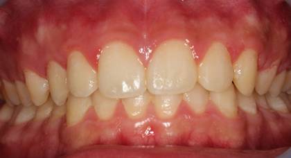 ぼやけた写真
AI 生成コンテンツは誤りを含む可能性があります。