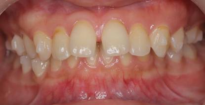 人の手
AI 生成コンテンツは誤りを含む可能性があります。