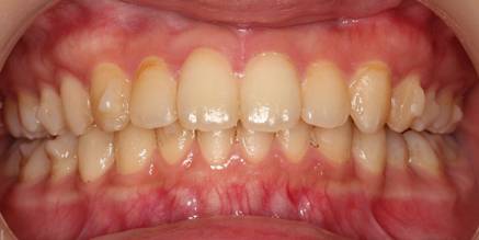 パスタのアップ
AI 生成コンテンツは誤りを含む可能性があります。