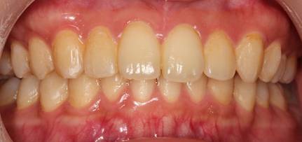 食品, ボウル, テーブル, 座る が含まれている画像
AI 生成コンテンツは誤りを含む可能性があります。