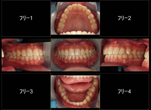 示している が含まれている画像
自動的に生成された説明