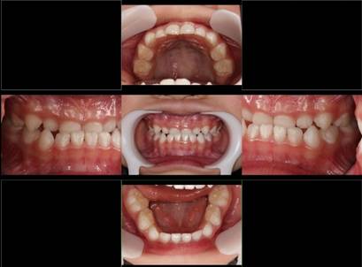 食品, 写真, 小さい, 座る が含まれている画像
自動的に生成された説明