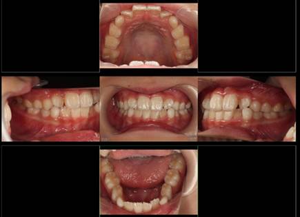 写真, 異なる, 食品, 座る が含まれている画像
自動的に生成された説明