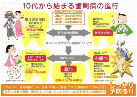 「歯周病菌 全身」の画像検索結果